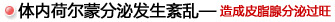 体内荷尔蒙分泌发生絮乱-造成皮脂腺分泌过旺